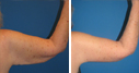 Before & After Photos